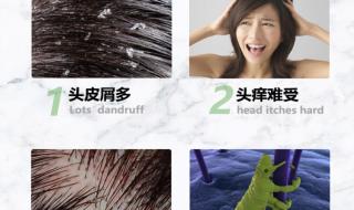 生发防脱洗发水10强排行榜 生长头发的洗发露